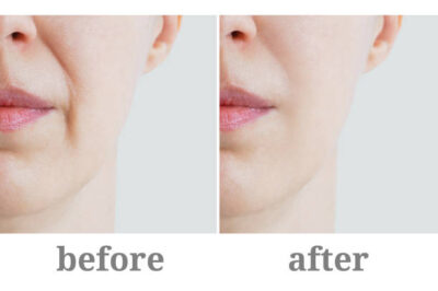 Vitamin E Moisturizer